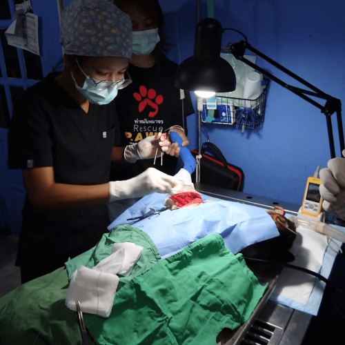 Amputation