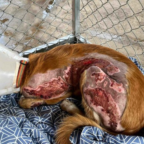 Burn case that required medical treatment